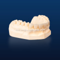 IPS Emax Lithium Disilicate Restorations
